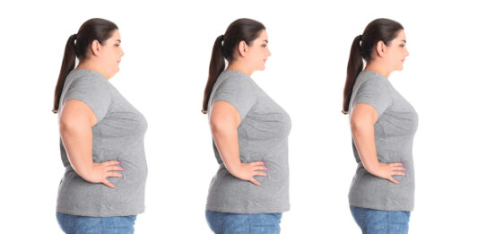 Exploring Weight Loss Surgery